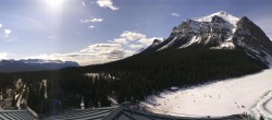 Archived image Webcam The Fairmont Chateau Lake Louise 08:00