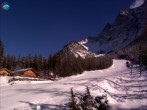 Archiv Foto Webcam Gamskarlift im Skigebiet Ehrwald 11:00