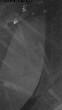 Archiv Foto Webcam Willingen: Auslauf Mühlenkopfschanze 01:00