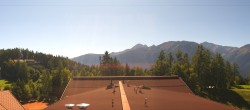 Archived image Webcam Mösern near Seefeld, Tyrol 11:00