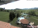 Archived image Webcam Hotel Dein Engel near Oberstaufen 11:00