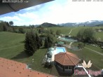 Archived image Webcam Hotel Dein Engel near Oberstaufen 13:00