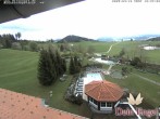 Archived image Webcam Hotel Dein Engel near Oberstaufen 11:00