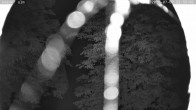 Archiv Foto Webcam Kaiseralm Breitenberg 23:00