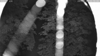 Archiv Foto Webcam Kaiseralm Breitenberg 23:00