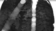 Archiv Foto Webcam Kaiseralm Breitenberg 23:00