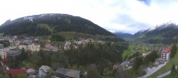 Archived image Webcam Hotel Schillerhof in Bad Gastein 13:00