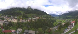 Archived image Webcam Hotel Schillerhof in Bad Gastein 11:00