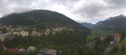 Archived image Webcam Hotel Schillerhof in Bad Gastein 11:00