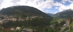 Archived image Webcam Hotel Schillerhof in Bad Gastein 13:00