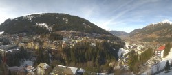 Archived image Webcam Hotel Schillerhof in Bad Gastein 11:00