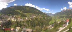 Archived image Webcam Hotel Schillerhof in Bad Gastein 11:00