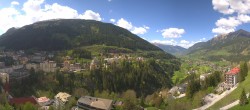 Archived image Webcam Hotel Schillerhof in Bad Gastein 13:00