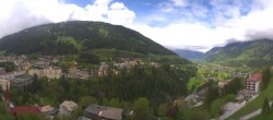 Archiv Foto Webcam Gasteinertal - Hotel Schillerhof 13:00