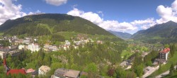 Archiv Foto Webcam Gasteinertal - Hotel Schillerhof 09:00