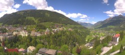 Archiv Foto Webcam Gasteinertal - Hotel Schillerhof 11:00