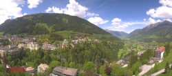 Archiv Foto Webcam Gasteinertal - Hotel Schillerhof 11:00