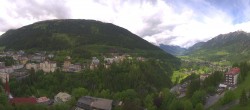 Archived image Webcam Hotel Schillerhof in Bad Gastein 11:00
