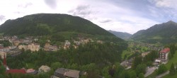 Archived image Webcam Hotel Schillerhof in Bad Gastein 11:00