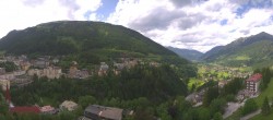 Archiv Foto Webcam Gasteinertal - Hotel Schillerhof 13:00