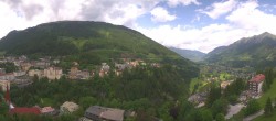 Archiv Foto Webcam Gasteinertal - Hotel Schillerhof 11:00