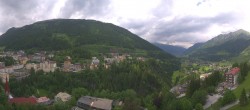 Archiv Foto Webcam Gasteinertal - Hotel Schillerhof 13:00