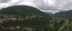 Archived image Webcam Hotel Schillerhof in Bad Gastein 15:00