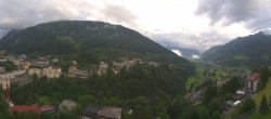 Archived image Webcam Hotel Schillerhof in Bad Gastein 05:00