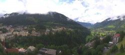 Archiv Foto Webcam Gasteinertal - Hotel Schillerhof 15:00