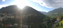 Archiv Foto Webcam Gasteinertal - Hotel Schillerhof 17:00