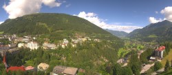 Archiv Foto Webcam Gasteinertal - Hotel Schillerhof 09:00