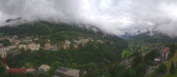 Archiv Foto Webcam Gasteinertal - Hotel Schillerhof 09:00