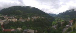 Archiv Foto Webcam Gasteinertal - Hotel Schillerhof 11:00
