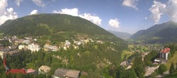 Archived image Webcam Hotel Schillerhof in Bad Gastein 09:00