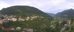 Archived image Webcam Hotel Schillerhof in Bad Gastein 09:00