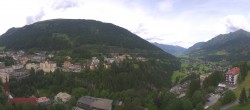 Archived image Webcam Hotel Schillerhof in Bad Gastein 11:00