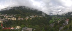 Archiv Foto Webcam Gasteinertal - Hotel Schillerhof 10:00