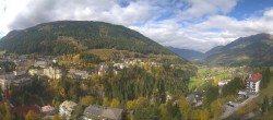 Archived image Webcam Hotel Schillerhof in Bad Gastein 11:00