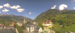 Archiv Foto Webcam Gasteinertal - Bad Hofgastein 11:00