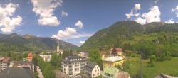 Archiv Foto Webcam Gasteinertal - Bad Hofgastein 11:00