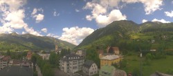 Archiv Foto Webcam Gasteinertal - Bad Hofgastein 11:00
