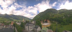 Archiv Foto Webcam Gasteinertal - Bad Hofgastein 11:00