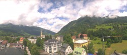 Archiv Foto Webcam Gasteinertal - Bad Hofgastein 11:00