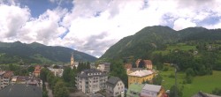 Archiv Foto Webcam Gasteinertal - Bad Hofgastein 11:00