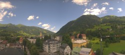 Archiv Foto Webcam Gasteinertal - Bad Hofgastein 11:00