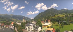 Archiv Foto Webcam Gasteinertal - Bad Hofgastein 11:00