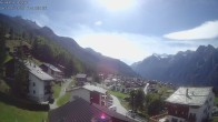 Archived image Webcam Egga - Grächen 13:00