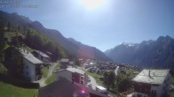 Archived image Webcam Egga - Grächen 13:00