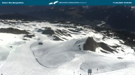 Archived image Webcam Top Station Hahnenköpfle - Ifenbergbahn 09:00