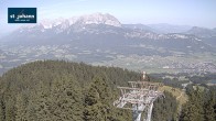Archiv Foto Webcam St. Johann/Tirol: Blick von der Bergstation Harschbichl 09:00
